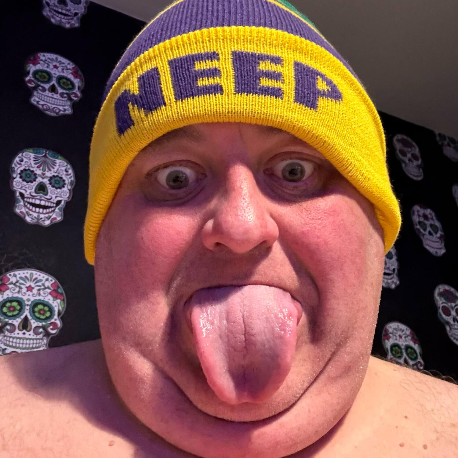 Damo wearing a Neep hat